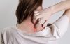 VACINADOS DE COVID CORREM RISCO DE CONTRAIR HERPES ZOSTER – ESTUDO CIENTÍFICO